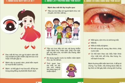 Bài tuyên truyền về bệnh đau mắt đỏ