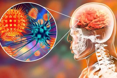 Cần làm gì để phòng chống bệnh do Virus Nipah
